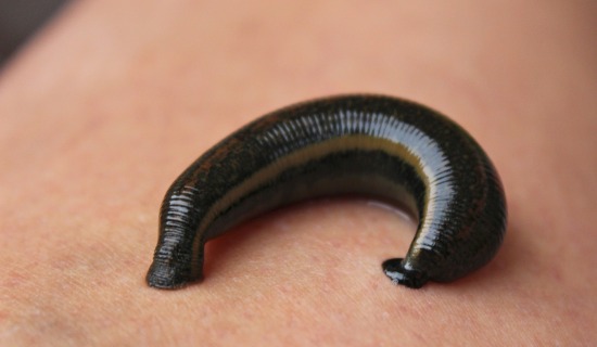 Sülük Uygulamasında Dikkat Edilmesi Gerekenler