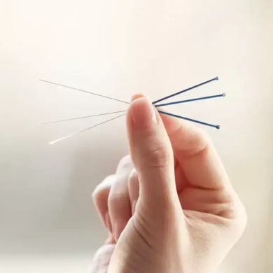 Akupunktur Tedavisi